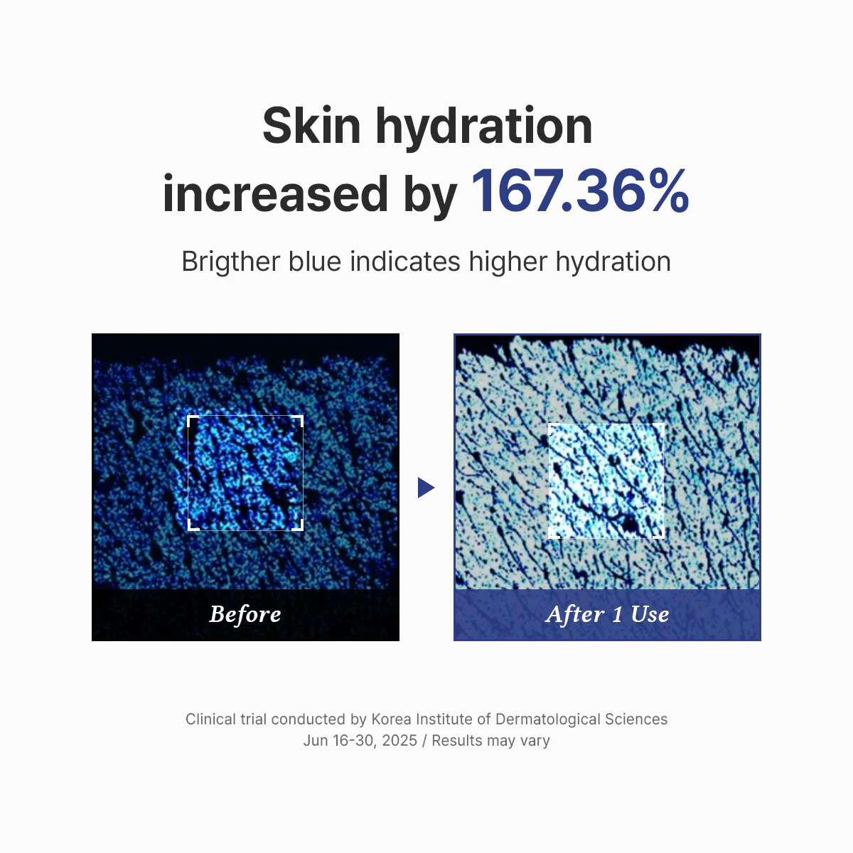 Acne & Barrier Care Duo - Image 7