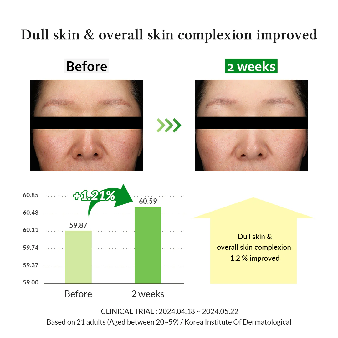 Gentle Vitamin C Serum - Image 5