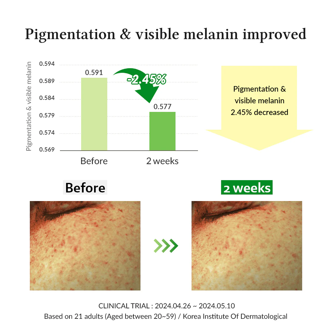 Gentle Vitamin C Serum - Image 6