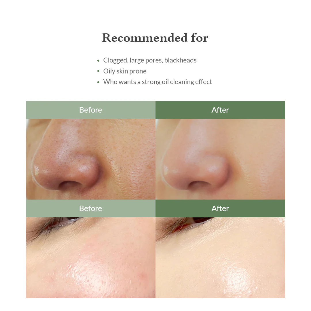 Premium Quick Step Sebum Cleanser - Image 6